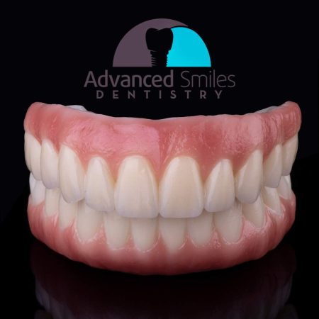 Home - Advanced Smiles Dentistry